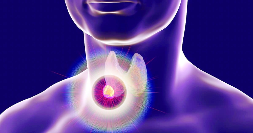 Destruction of thyroid tumor